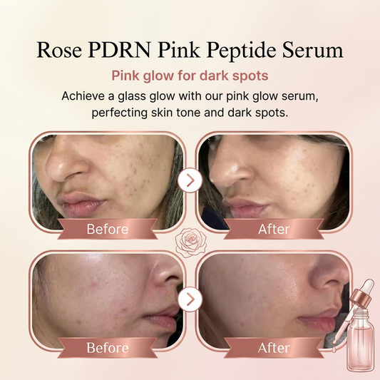 - PDRN Pink Peptide Serum (30Ml)